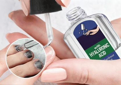Solution Antifongique de Réparation des Ongles