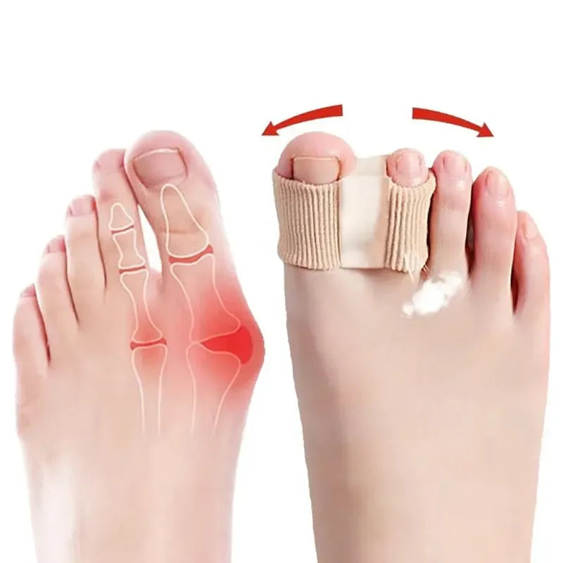 Paire de séparateurs d’orteils en gel – Correction Hallux Valgus
